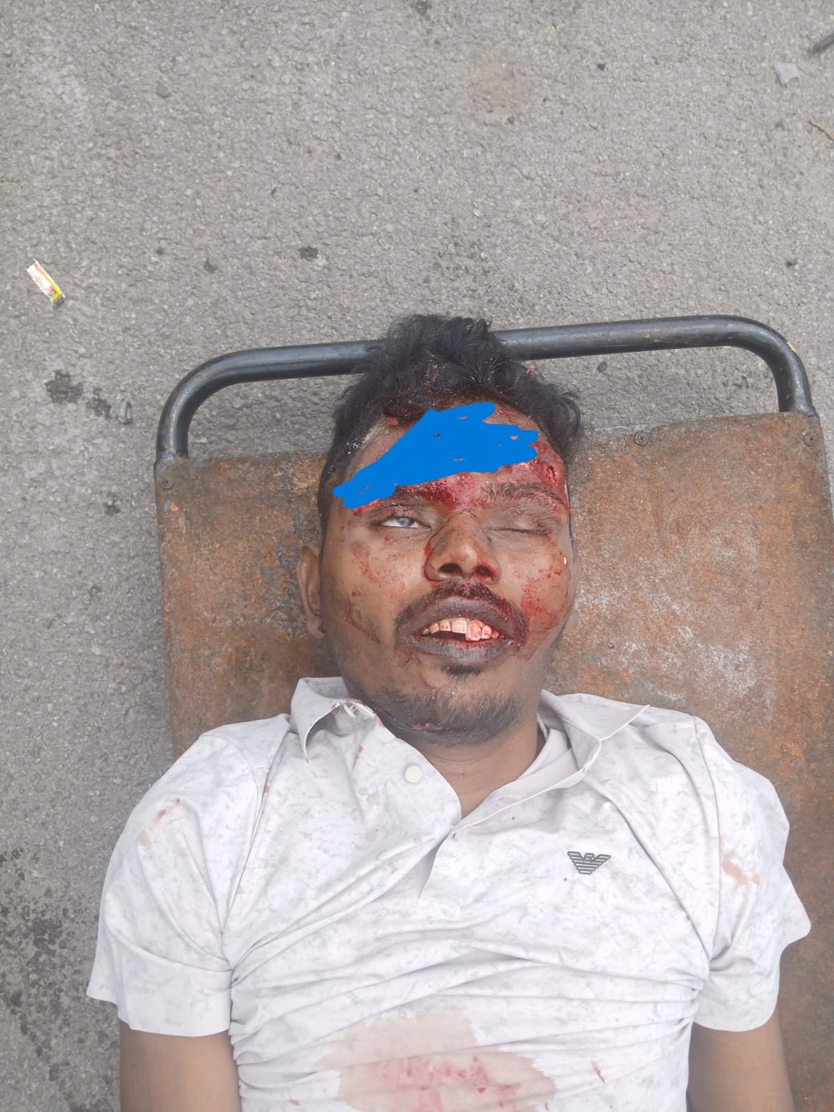 ప్రమాదంలో గాయపడిన అలేటి శిరీష్ కుమార్